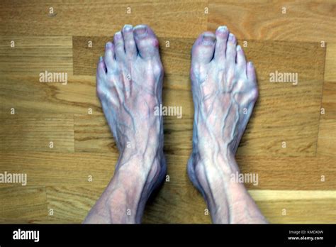 ugly feet pics|Ugly Feet Photos and Premium High Res Pictures .